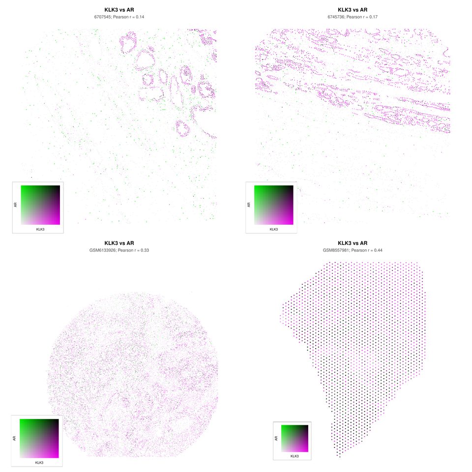 Spatial colocalization of KLK3 and AR